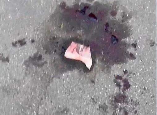 Бретельками лифчика девушки спасли пострадавшего в поножовщине в Обнинске Бретельками лифчика девушки спасли пострадавшего в поножовщине в Обнинске